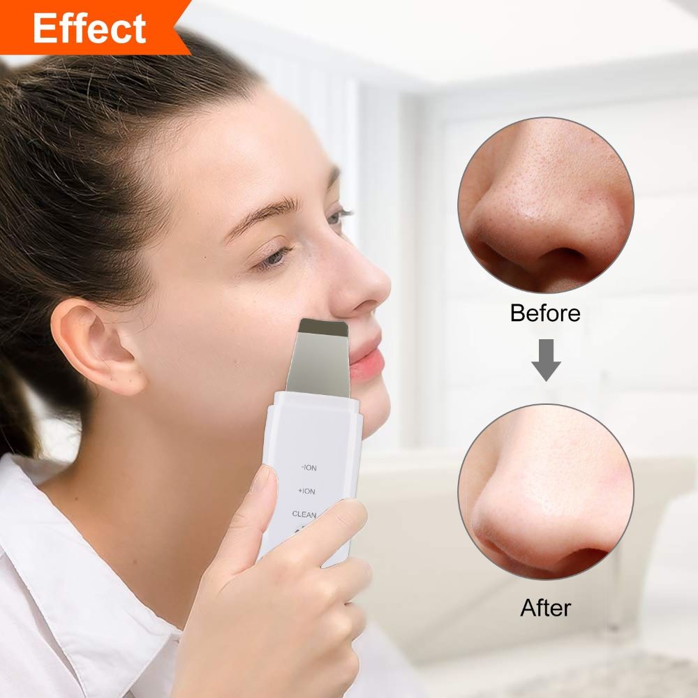 Spatule ultrasonique ionique professionnelle pour le nettoyage du visage (épurateur de peau/skin scrubber)